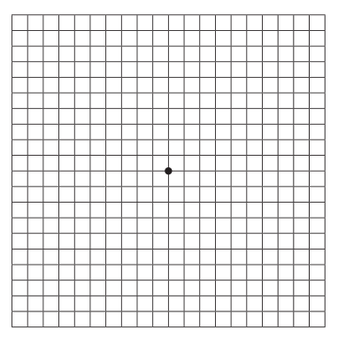 The Amsler Grid, Westside Eye Clinic