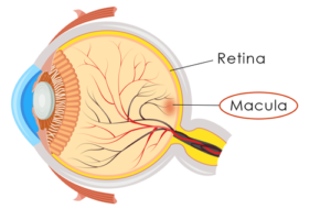 Macular Degeneration