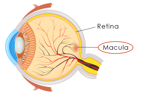 age related macular degeneration